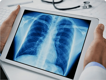 Teleradiology Services